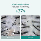 lilyeve - Scalp Turn Cica PDRN Brush Ampoule 100ml