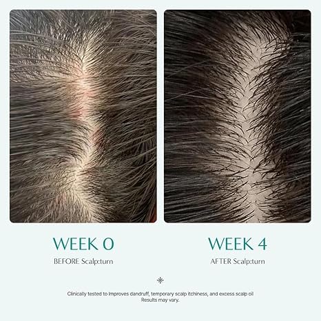 lilyeve - Scalp Turn Cica PDRN Brush Ampoule 100ml
