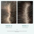 lilyeve - Scalp Turn Cica PDRN Brush Ampoule 100ml