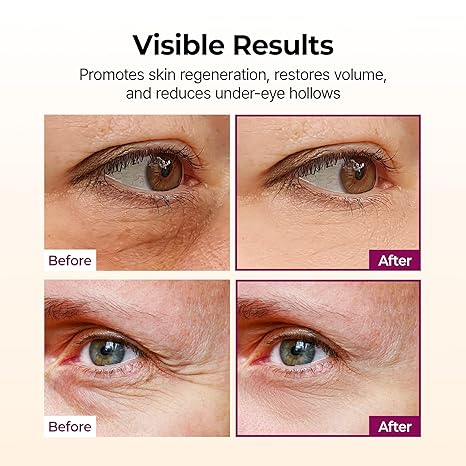 Dr.Melaxin - Calcium Volume Multi Balm 9g
