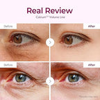 Dr.Melaxin - Cemenrete Calcium Volume Eye Patch 62pcs