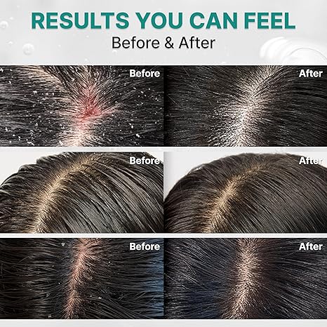 lilyeve Scalp:Turn Cica PDRN Deep Clean Shampoo 500ml