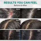 lilyeve Scalp:Turn Cica PDRN Deep Clean Shampoo 500ml