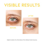 OOTD - Dark Circle Eye Serum 30g