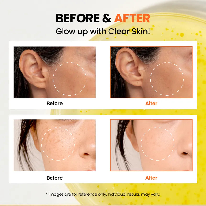 KSECRET - SEOUL 1988 Glow Serum : Niacinamide 15% + Yuja 30ml