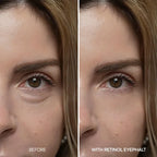 Dr.Melaxin - Eyephalt Retinol Eyebag Cream 10g