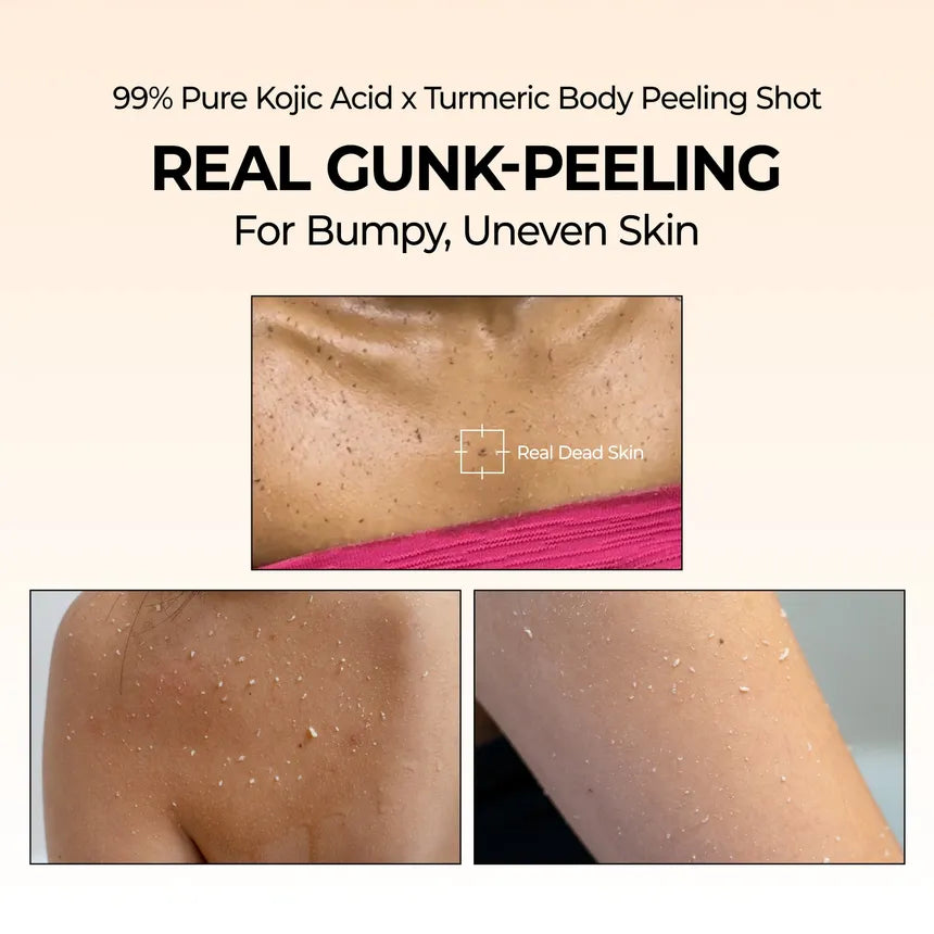 Dr.Melaxin - Peel Shot Exfoliating Kojic Acid Turmeric Spray 200ml