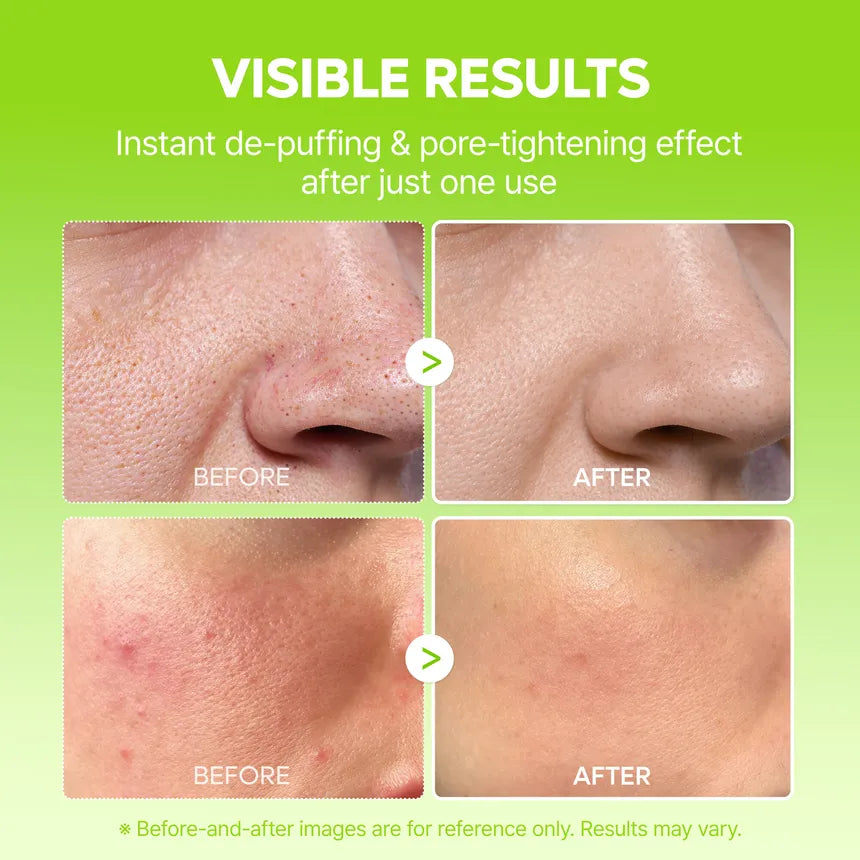 Dr.Melaxin - Cactox Pore Relief Jelly Serum Mist 80ml