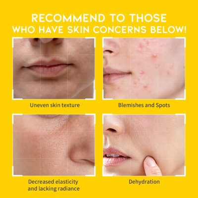 OOTD VITAMIN C DARK SPOT TONER PAD (70pads)
